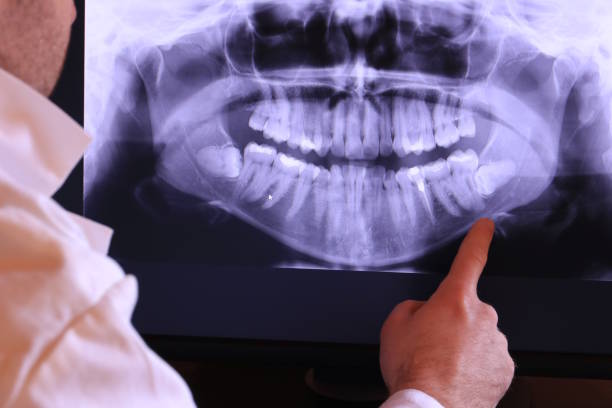 Best Teeth Whitening  in St Martin, MS