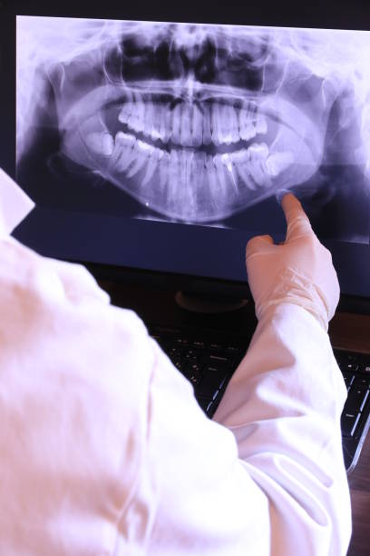 Best Root Canal Emergency Dentist  in St Martin, MS